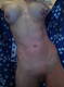 lato A